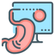 Endoscopic Ultrasound (EUS) Treatment